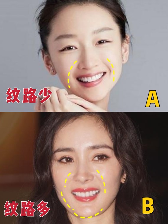 好看的鼻子类型驼峰鼻,好看的鼻型有哪几种