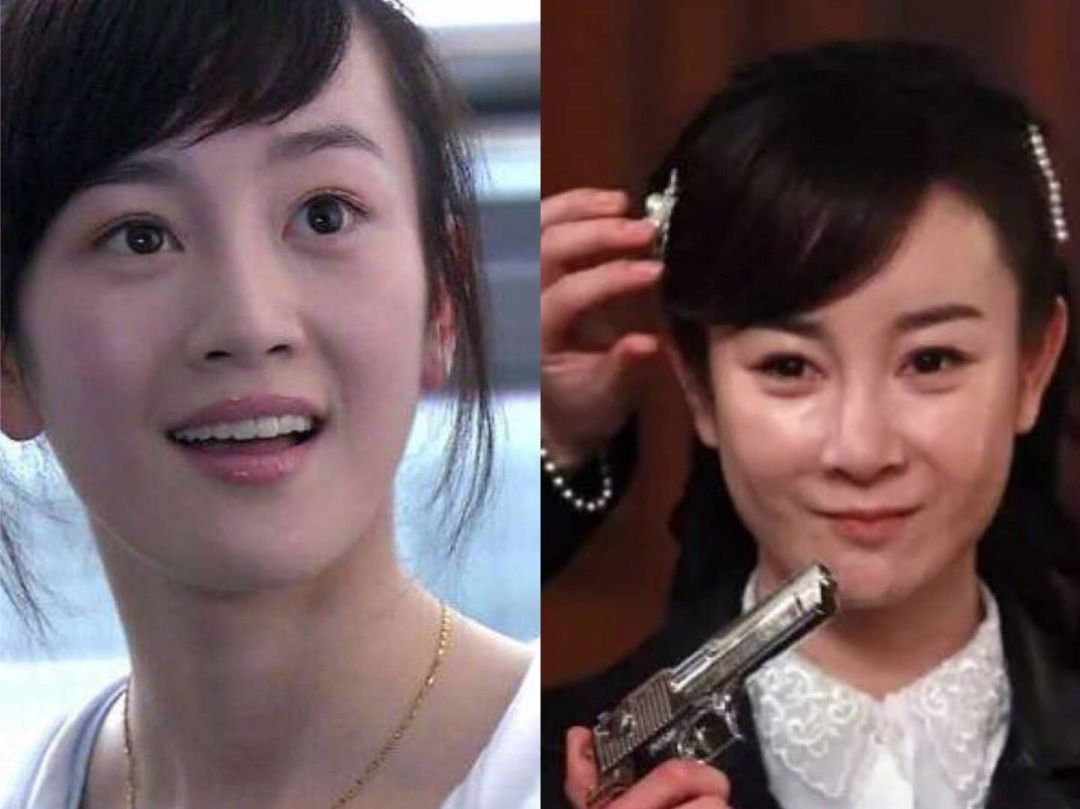 女明星整容脸垮了,容貌焦虑动刀整容案例