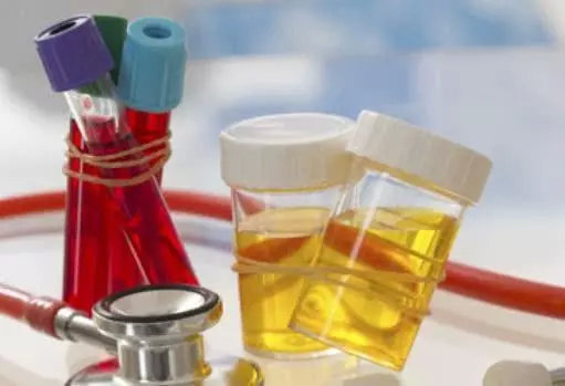 年轻人尿潜血是什么原因,尿潜血是什么原因形成的