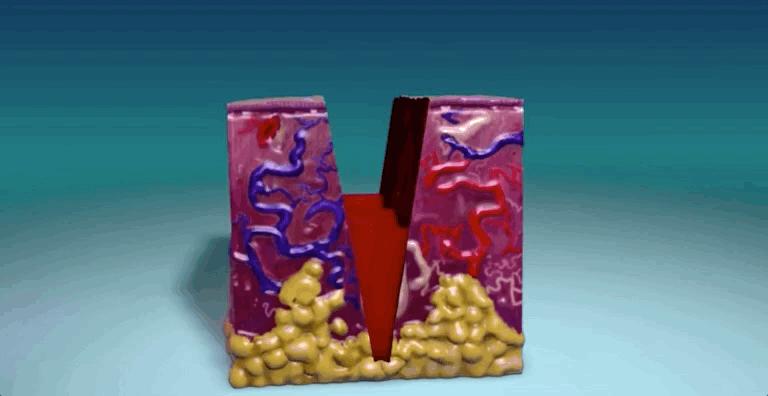 揭秘伤口如何愈合的,伤口是如何愈合的告诉小朋友