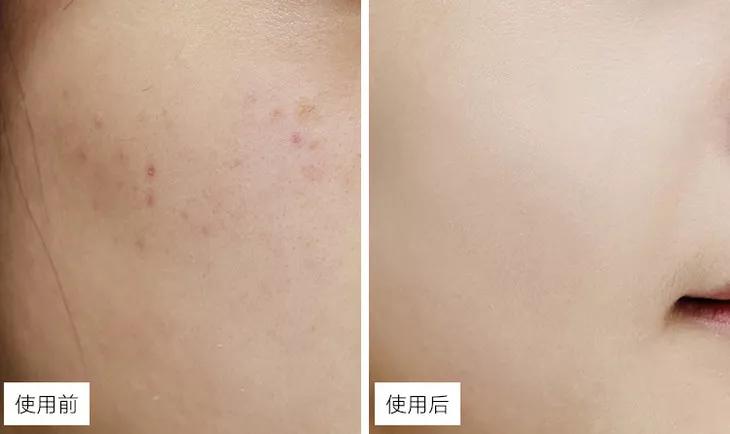 堪比大牌的平价乳霜,日本平价保湿面霜推荐