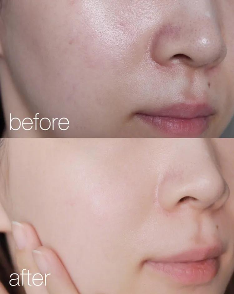 无需美颜轻松拥有水光肌,哪有天生的好底子