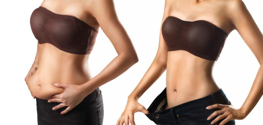 剖腹产后大肚腩减肥手法,产后大肚子如何减脂减重瘦下来