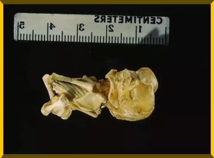 赵丽颖产子后现状,赵丽颖哪年产子