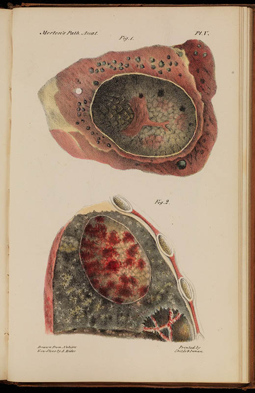 19世纪欧洲殖民扩张的原因,欧洲19世纪为啥出现大量精神病