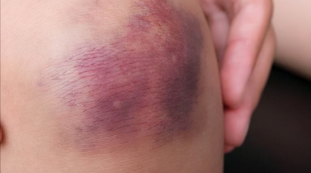 1992年山西工人捡到发光圆柱,1992年山西一工人捡到一根金属棒