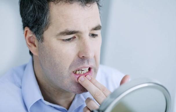 牙龈长硬疙瘩不痛不痒的图片,牙龈疙瘩不痛不痒