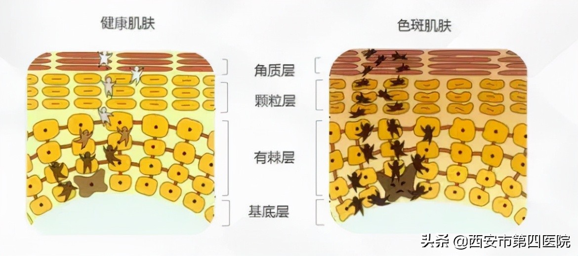 #安心变美课堂##我的安心变美推荐#美白，原来这也有满分操作