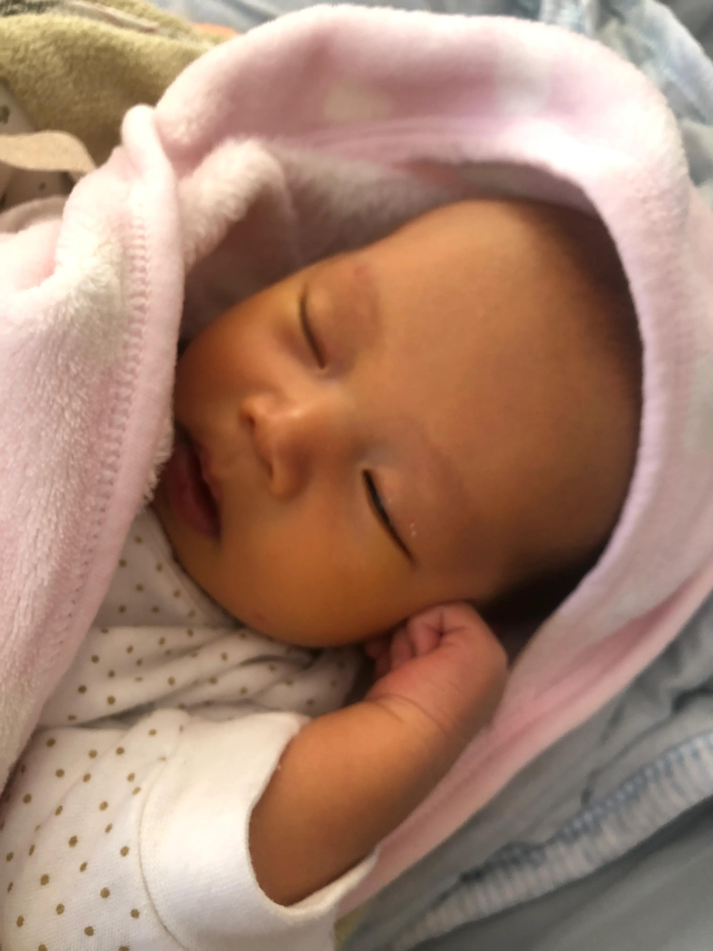 20天的宝宝，黄疸高得眼睛都黄了，家人都表示不用去医院