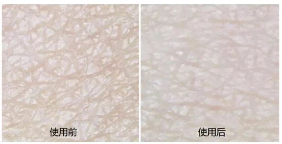 女人最好的状态就是富养,女人要富养但不是娇生