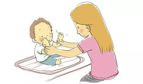 五个月婴儿湿疹,二胎孕期爆发湿疹