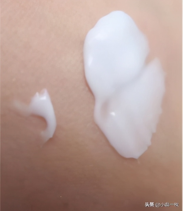 刷酸后爆痘持续多久,刷酸爆痘怎么处理