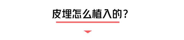 小小一根棒，比套套和上环安全，避孕率超高却少有人知道...