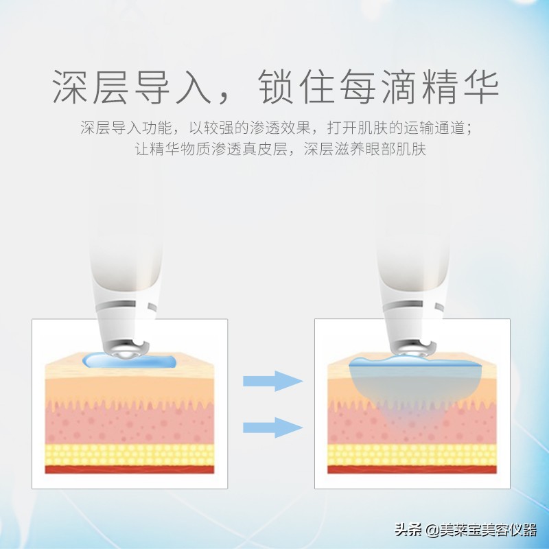 消除鱼尾纹的药膏,怎样消除眼角鱼尾纹
