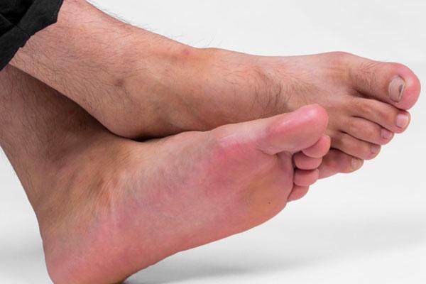 脚指甲长肉里一碰就疼用什么工具,脚指甲两边长进肉里好疼怎么办