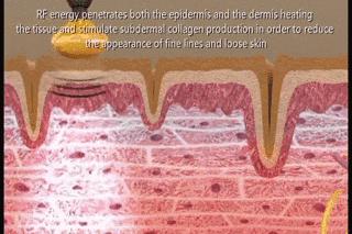 家用美容仪怎么选适合自己的,简单实用美容仪