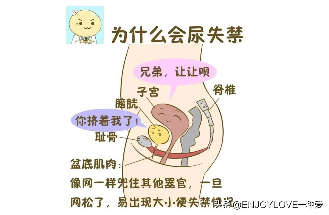 产后怎么锻炼盆底肌才不会漏尿,产后漏尿是哪里受损了