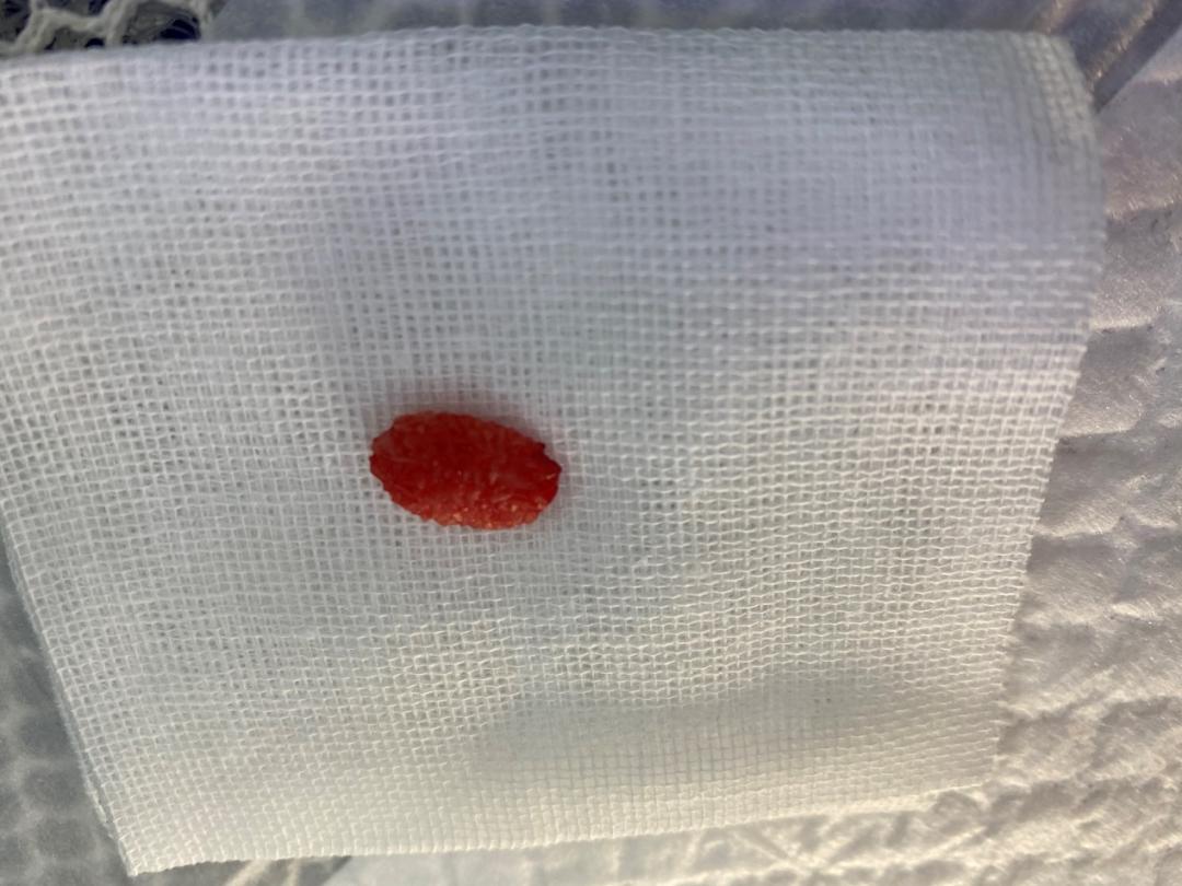 猫咪尿血伴有膀胱黏膜脱落,为什么猫咪会尿结石尿血