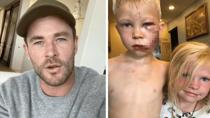 真英雄！6岁男孩为救妹妹被狗咬伤，“复仇者”送来了最棒的礼物