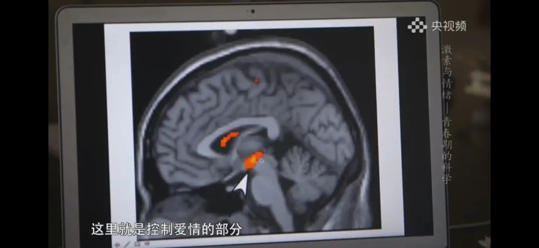 提前发育的孩子要注意什么,如何正确认识孩子提前发育