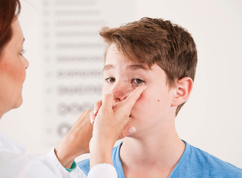 上海和平眼科医院医生,100度以下角膜塑形镜可以恢复视力