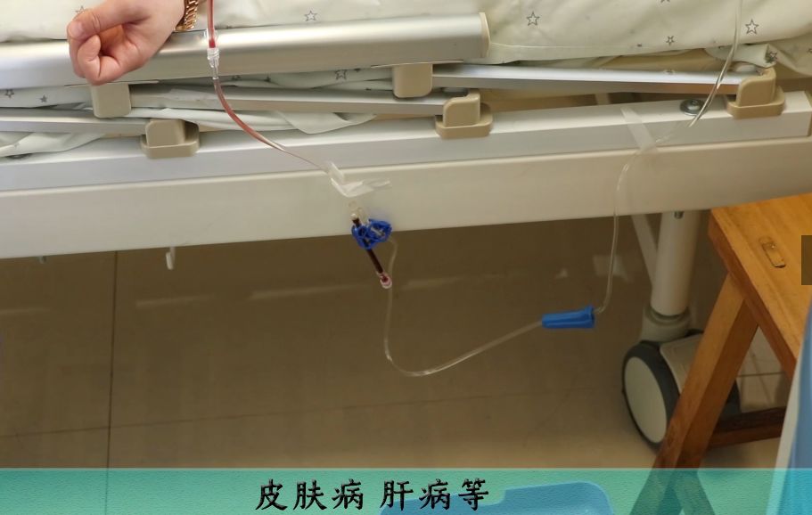 三氧血液净化绿色疗法,黑科技祛红血丝