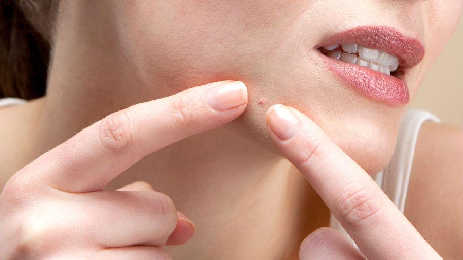 怎么分辨毛孔越来越大的原因,什么可以使毛孔打开