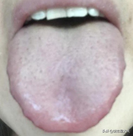 中医晚上口渴老想喝水什么原因,老中医告诉你一到晚上就口干