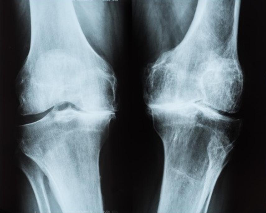 不要让孩子继续矮下去,别让孩子太晚睡觉长不高