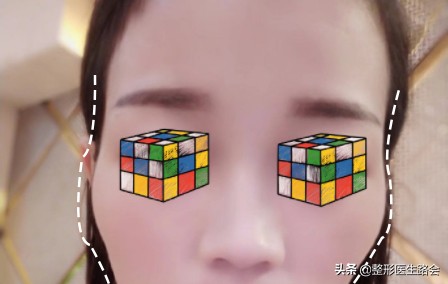 颧骨颧弓内推手术会让脸变小吗,颧骨内推手术有什么后遗症