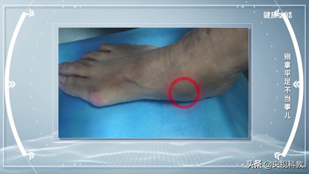 腰疼引起腿和脚麻是怎么回事,经常腰痛原来是脚的问题