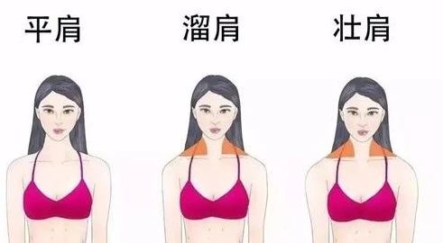 斜方肌肥大的主要原因是什么,斜方肌肥大是不是锁骨就不明显