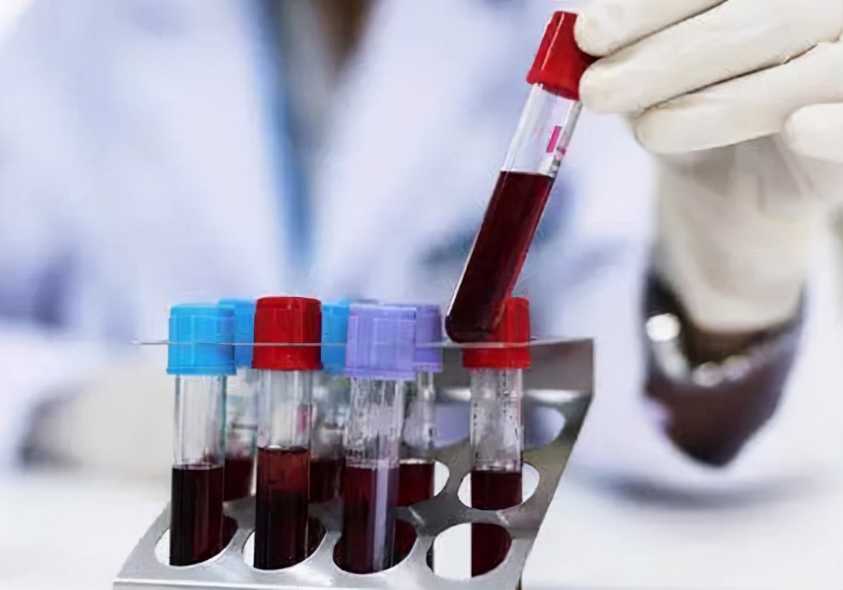 男子肾衰竭多年,被查出肾衰