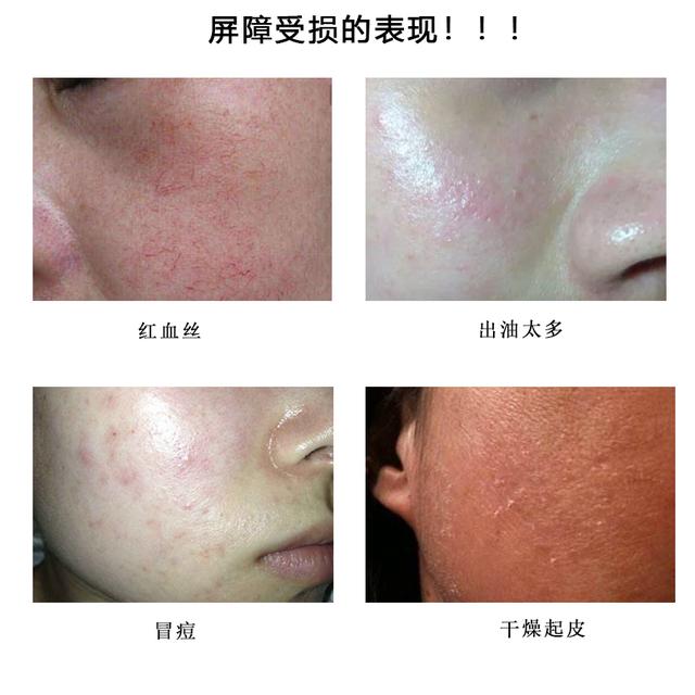 倩碧黄油好用吗真实测评,倩碧经典黄油