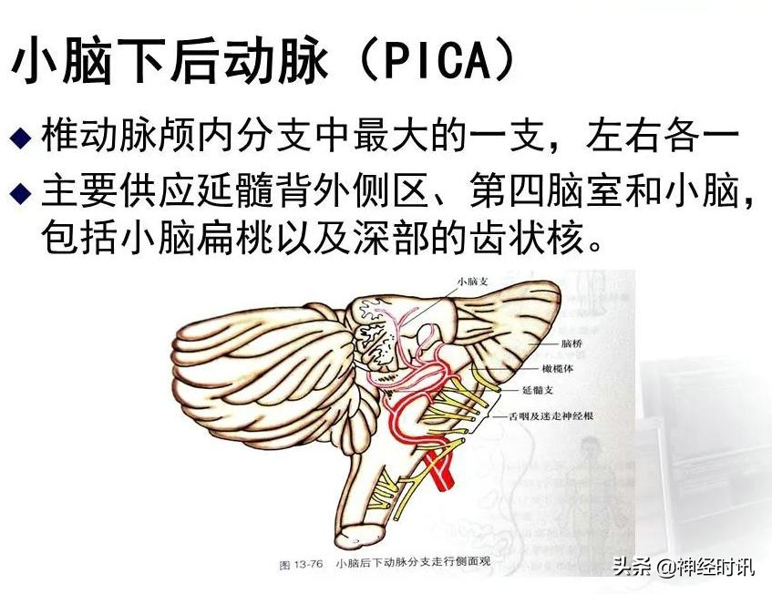 脑动脉解剖学讲解,脑膜中动脉解剖讲解