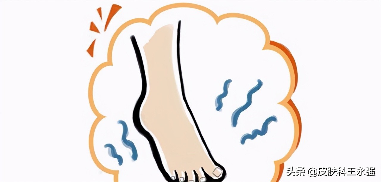 脚气如何根除教你四个方法,夏天脚气怎么根除小妙招