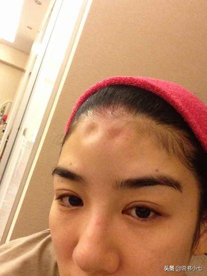 黄奕前夫黄毅清现在怎样了,黄毅清和黄奕的婚姻