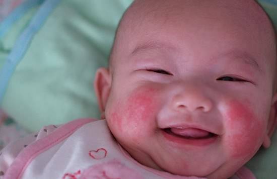 皮肤起皮干燥有碎屑用什么护肤,干燥皮肤的正确护肤方法