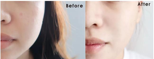 用了很多护肤品还是不白,白月光护肤品哪个更提亮皮肤