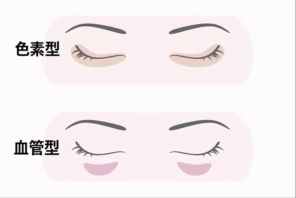 对付黑眼圈最好用的眼霜,真正对黑眼圈有用的眼霜