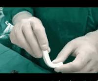 鼻整形手术风险,鼻整形副作用