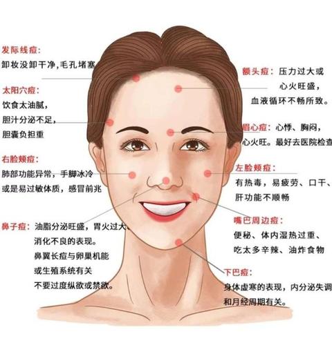 突然间长很多痘怎么祛痘,痘痘冒白尖后正确的祛痘解决方法