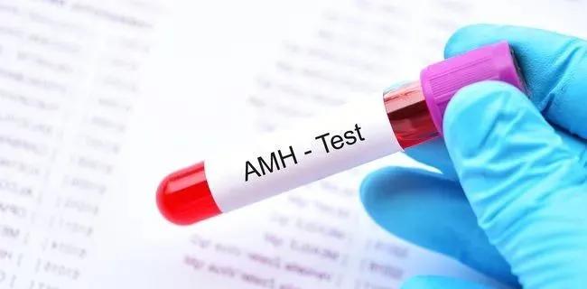 amh值偏高是卵巢功能不好了吗,amh检测是智商检测吗