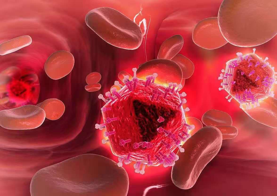 肾钙沉积危害及原因,肾钙盐沉着