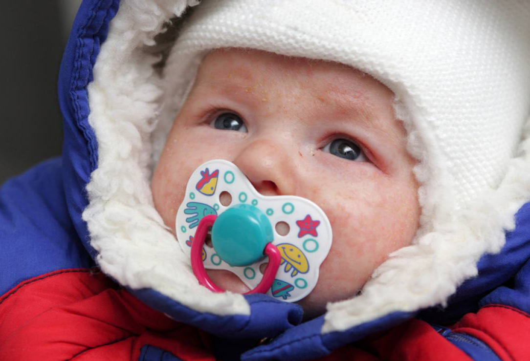 脸上起湿疹是什么原因造成的,宝宝起湿疹怎么办