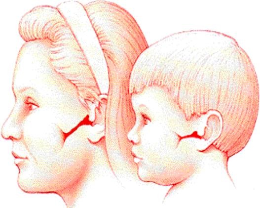 治中耳炎用眼药水,中耳炎常用药