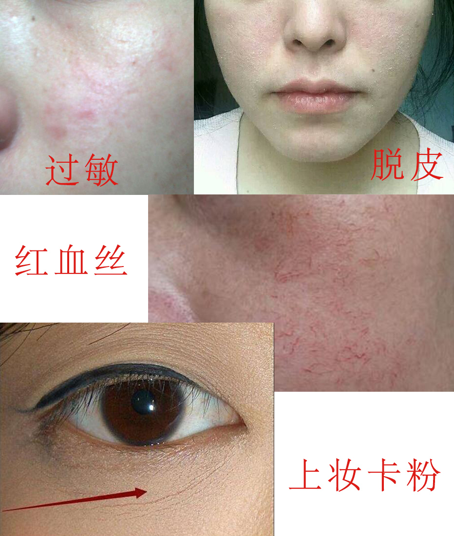 张韶涵坚持用护肤油5年，宋轶直接把油涂全身，难怪皮肤嫩出水