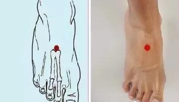 艾灸1小时,迅速提升下垂脸!简简单单就变美