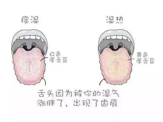 妇科炎症要吃什么药才能治愈,妇科炎症喝什么中药调理