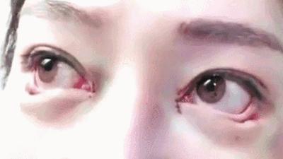 医美最火的项目,哪些皮肤类医美项目不建议做